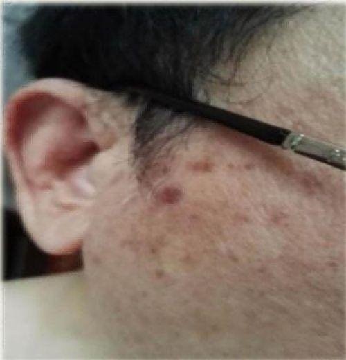 2026元旦特别报道量子氢氧健康第一人长寿哥(廖永贵)