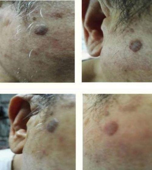 2026献礼两会特别报道 量子氢氧健康第一人长寿哥(廖永贵)