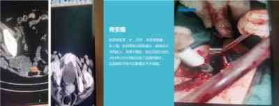 大国医者 国医名师——宁永球